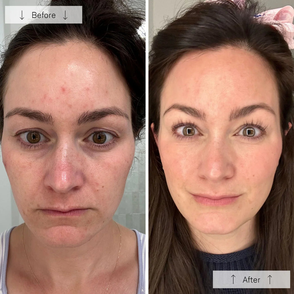 Therava Contour Mask