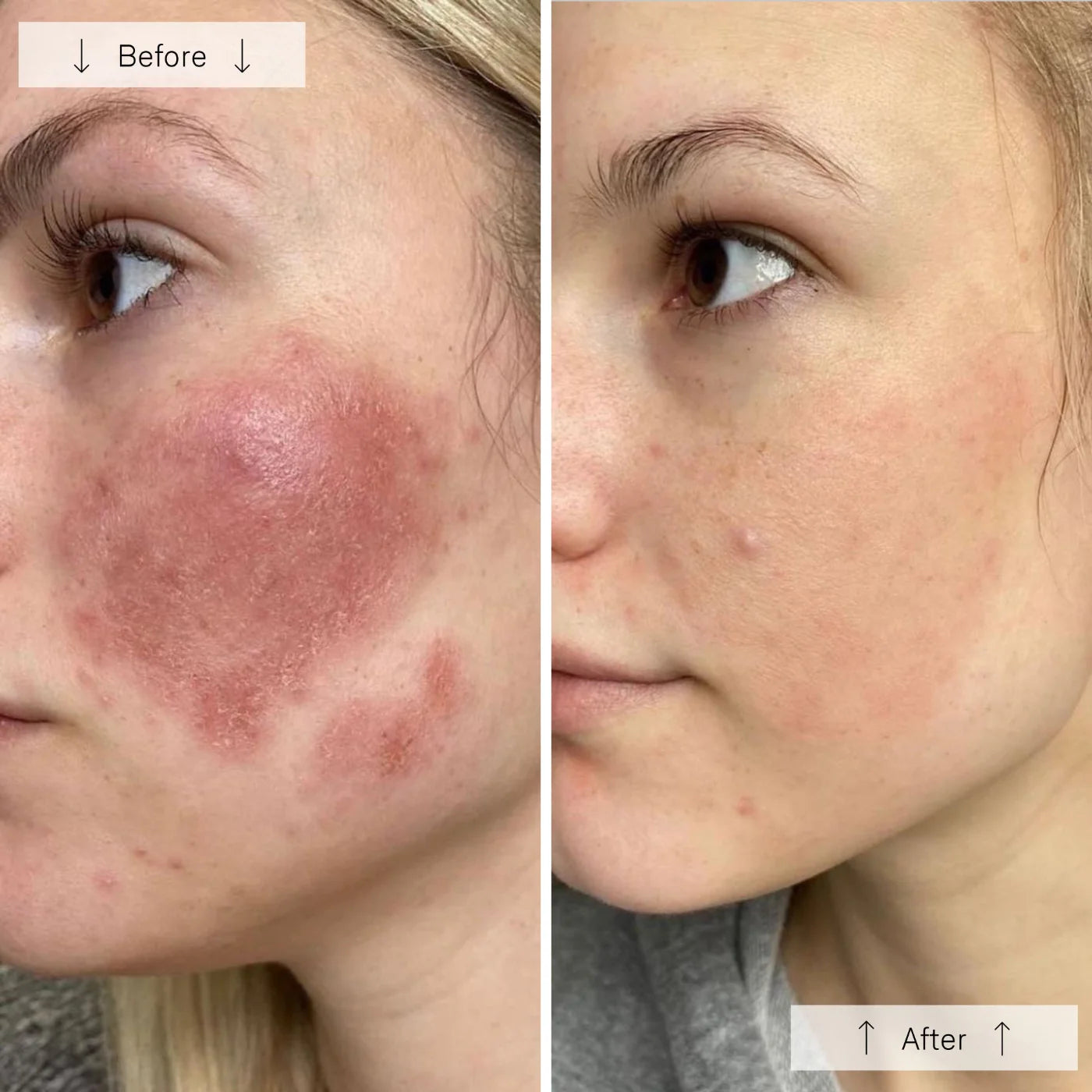 Therava Contour Mask